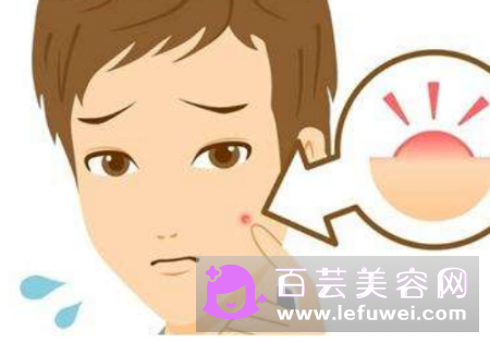 青春痘几岁开始长几岁停止 为什么有人不长