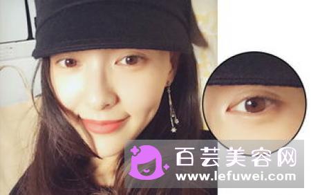 美瞳选大直径的还是小直径的好