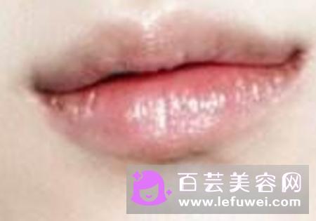 什么是仰月唇明星有哪些