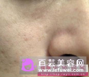 面霜抹上刺痛一会消失 护肤品擦了粘粘的好吗