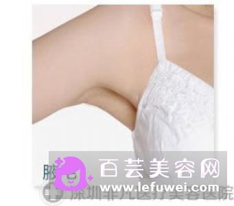腋毛为什么长得快?会不会越脱毛越粗?