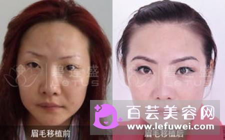 纹眉是什么原理 是要把眉毛刮掉吗