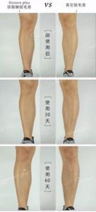 腿毛可以用脱毛膏吗浓密的原因是什么