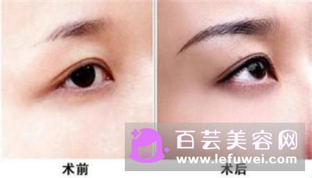 纹眉是什么原理 是要把眉毛刮掉吗