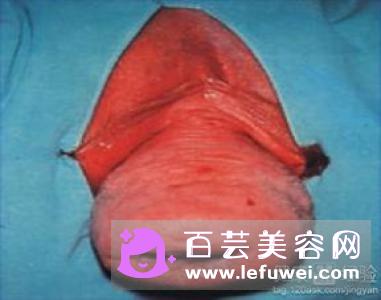 跑步会导致子宫下垂吗 女生跑步减肥的注意事项