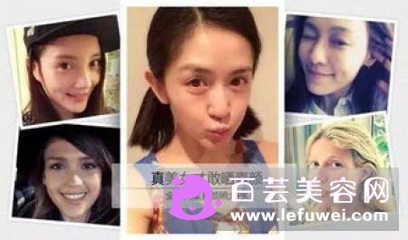素颜滴的功效与作用有哪些?停用后会怎么样