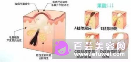 红蓝光治痤疮需要几次 有哪些好处