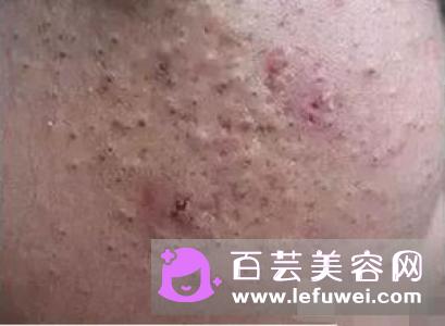 zuzu火山泥可以洗脸吗 怎么用